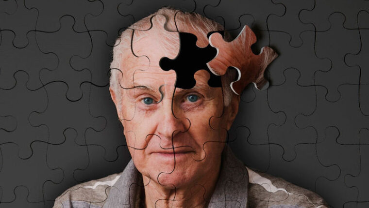 Die Alzheimer-Krankheit aufgedeckt: Ursachen Die Alzheimer-Krankheit aufgedeckt: Ursachen