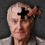 Die Alzheimer-Krankheit aufgedeckt: Ursachen